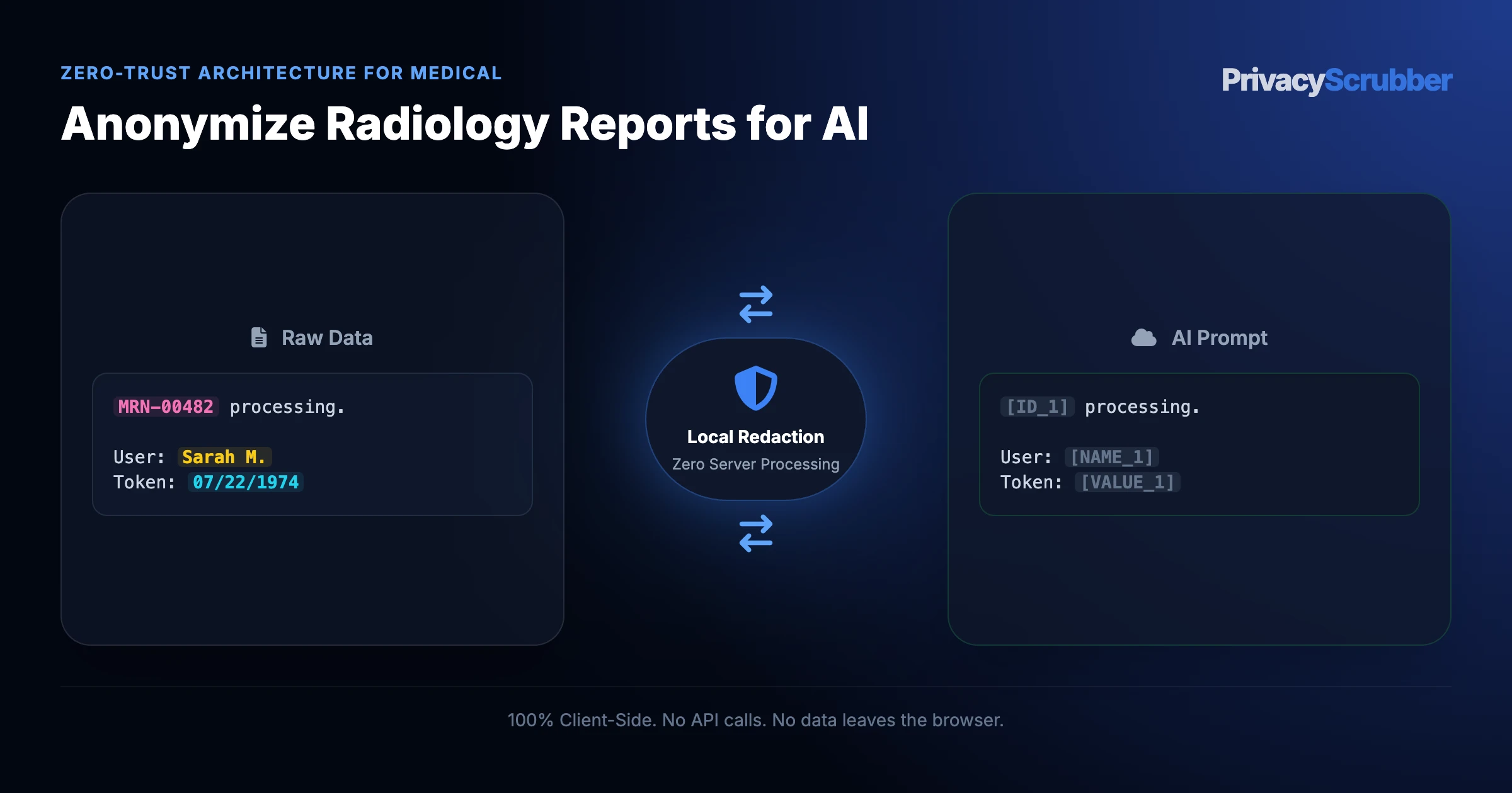 Anonymize Radiology Reports for AI